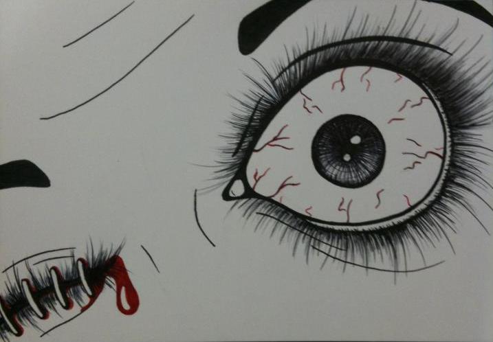 Bloody Eye